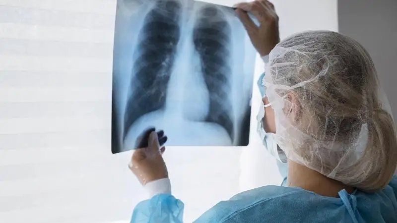 Debrecenben a tüdőrák megelőzéséről tartottak előadásokat