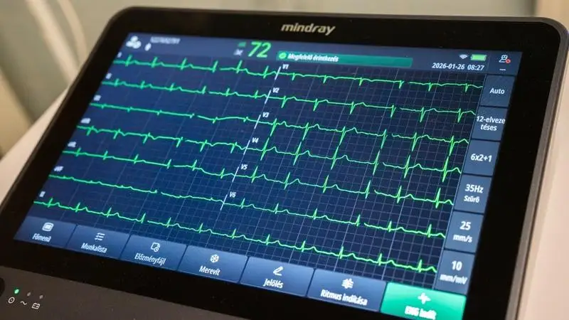 Digitális EKG-ra váltott a debreceni sürgősségi betegellátás